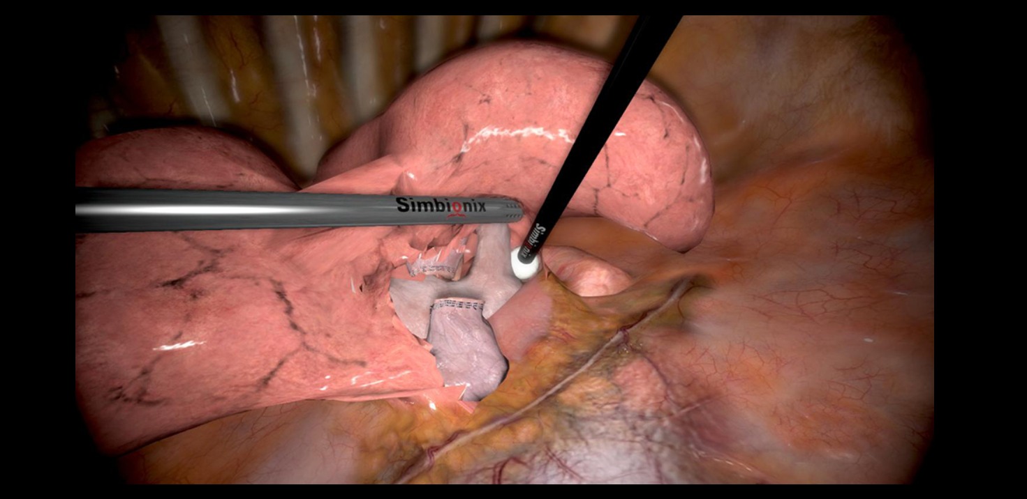 obraz z monitora przedstawia fragment elementu symulującego organ wewnętrzny oraz dwa narzędzia chirurgiczne wykonujące procedurę medyczną